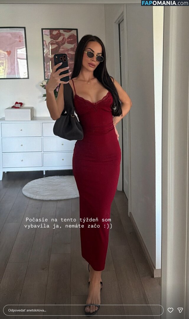 Anet Slotova / anetslotova Nahý OnlyFans  Uniklá fotka #1