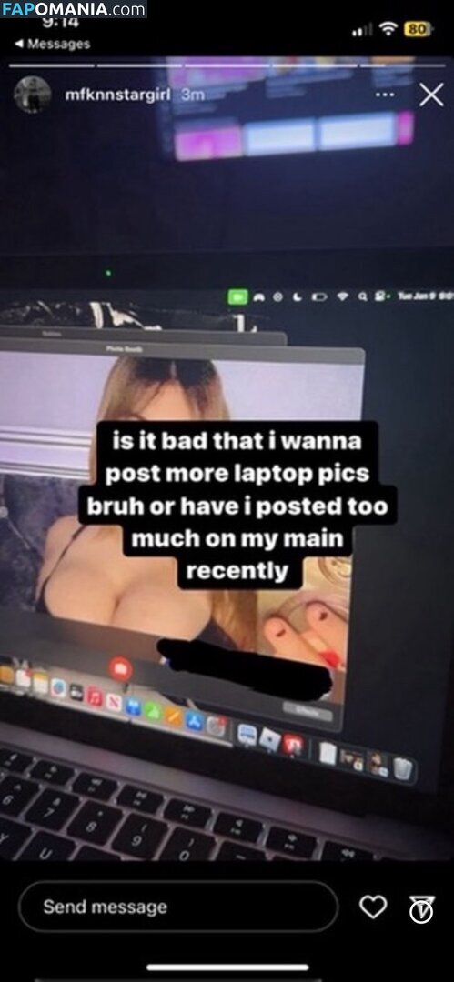 Mfknnstargirl Nahý OnlyFans  Uniklá fotka #12